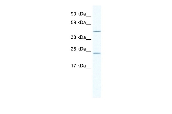 ANXA11 Antibody