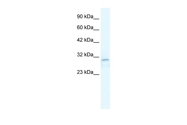 TRPM3 Antibody