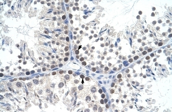 Tfam Antibody