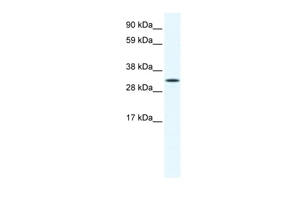 AIP Antibody