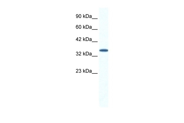 AIP Antibody