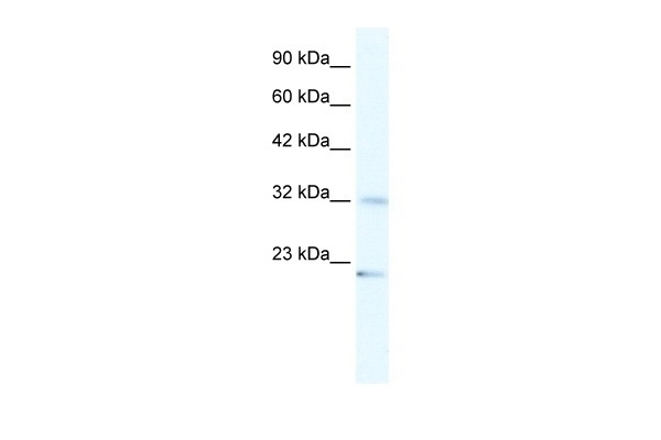 ZNF265 Antibody