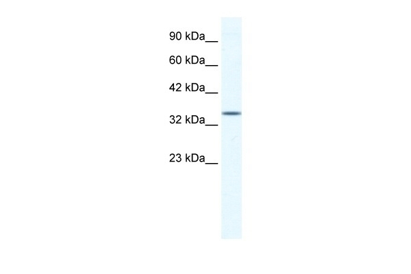 ZFP589 Antibody