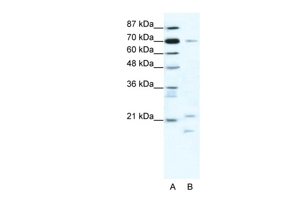 BTF3 Antibody