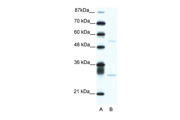 ATF4 Antibody