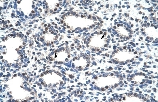 SMARCD2 Antibody