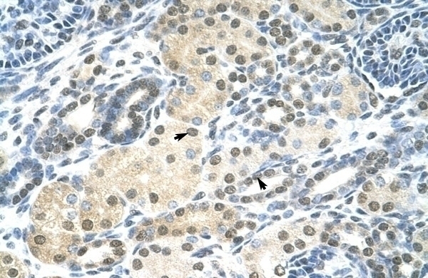 SMARCE1 Antibody