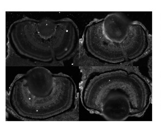 CDK5 Antibody
