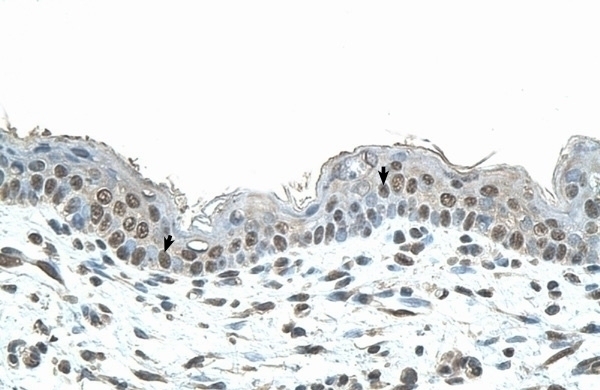 SMAD1 Antibody