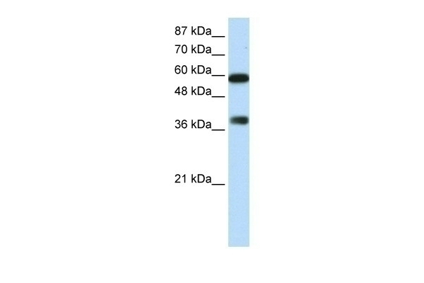 ARID3B Antibody