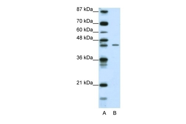 ZNF17 Antibody