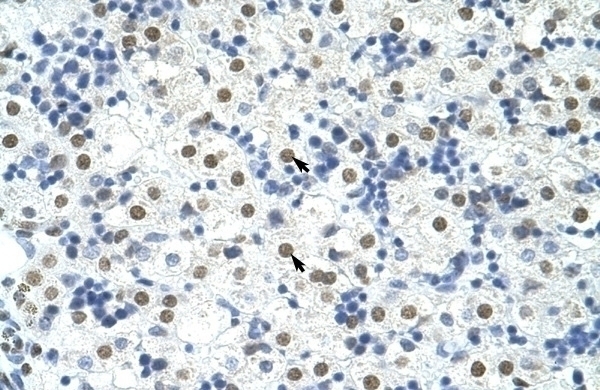 TARDBP Antibody