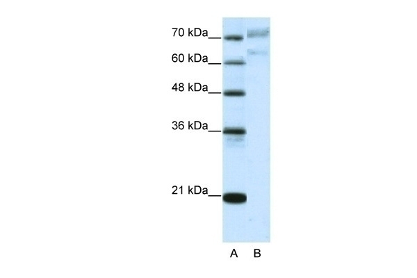 AATF Antibody