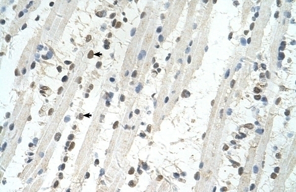 TRIM32 Antibody