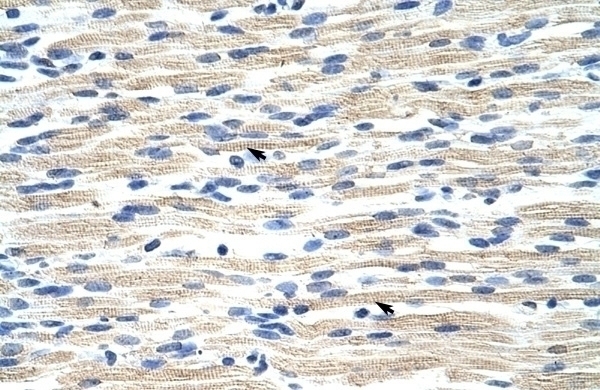 CBX6 Antibody