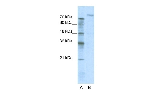 ZHX2 Antibody