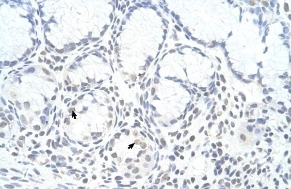 ZNF580 Antibody