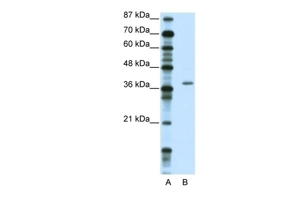 ZNF444 Antibody