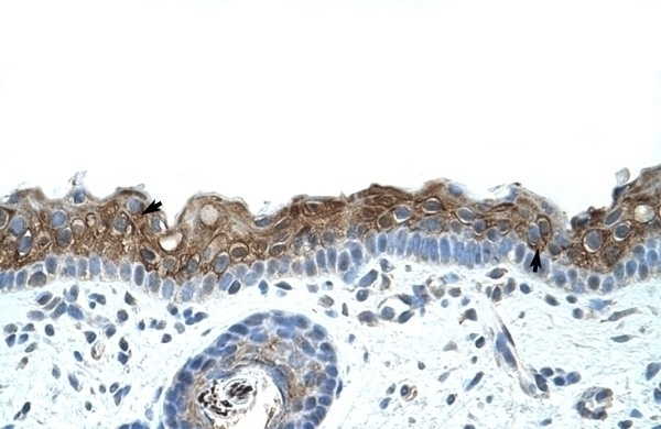 ZNF397 Antibody