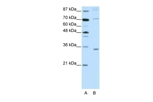 ATOH8 Antibody