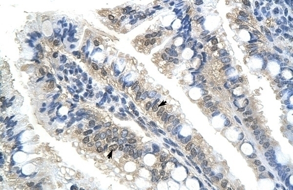 BTBD14B Antibody