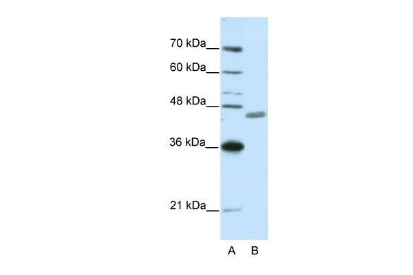 ZNF396 Antibody