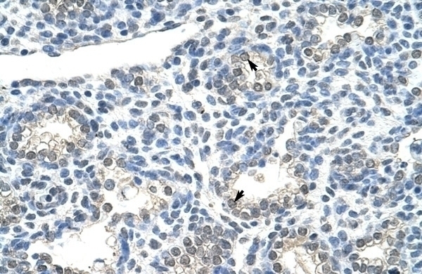 ZNF786 Antibody