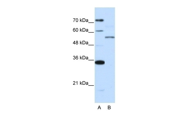 ZNF707 Antibody