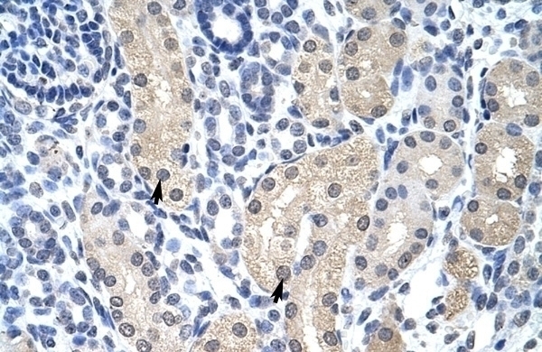 APTX Antibody