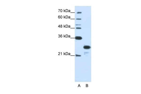 ANP32A Antibody