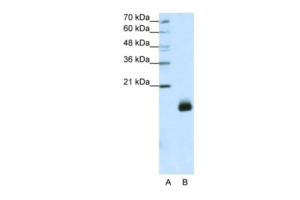 RPS14 Antibody
