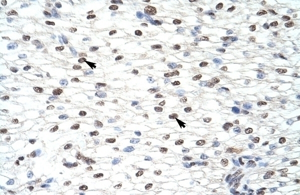 CUGBP2 Antibody
