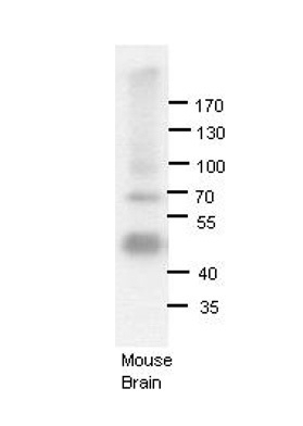 ADARB1 Antibody