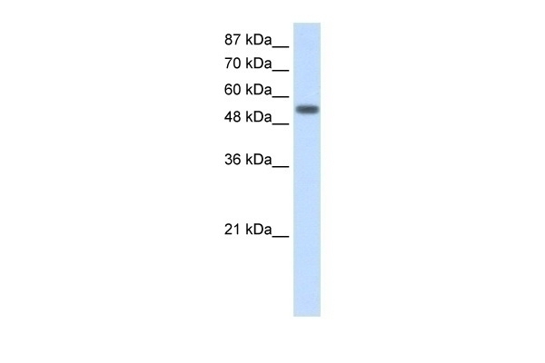 YARS Antibody