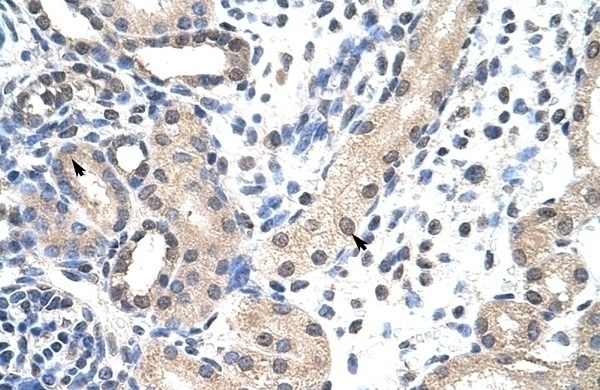 SNRPD1 Antibody