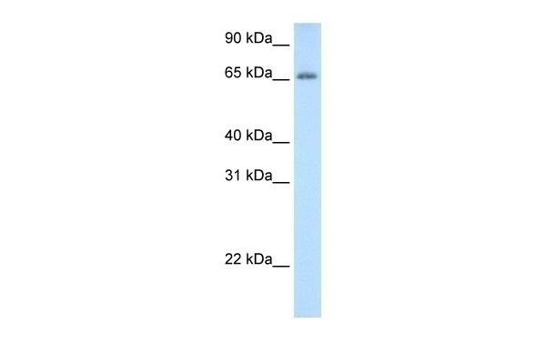 ADAT1 Antibody