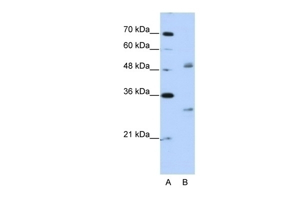 WBSCR1 Antibody