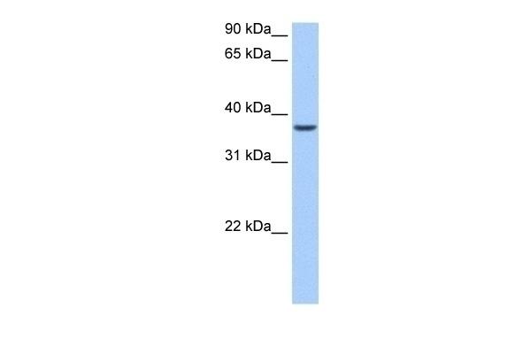 ALKBH8 Antibody