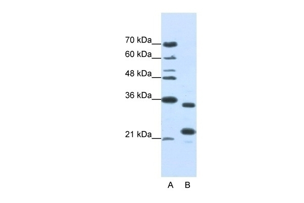 ALKBH8 Antibody