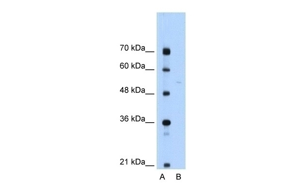 SLA/LP Antibody