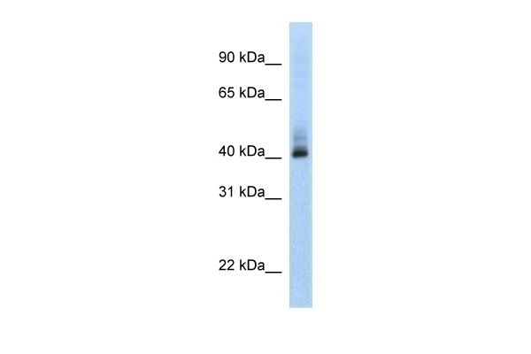 ANKRD42 Antibody
