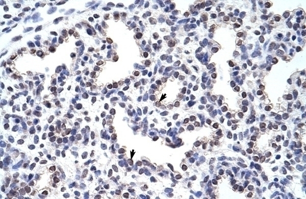 WNT2B Antibody