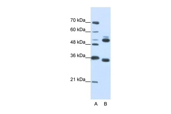 WDR6 Antibody