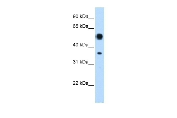 ASL Antibody
