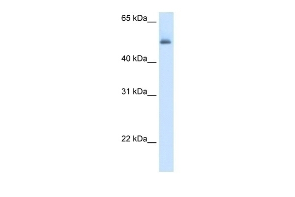 ASL Antibody