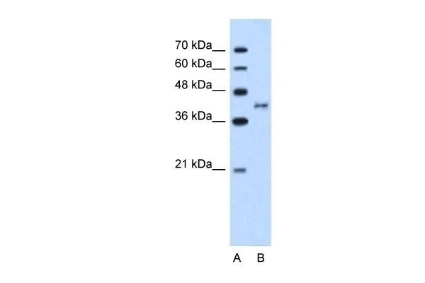 BDKRB2 Antibody
