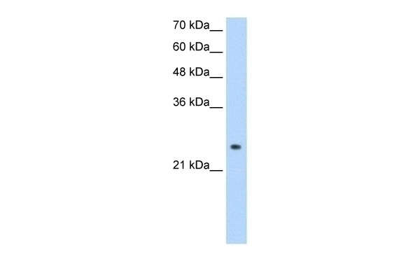 ADH6 Antibody