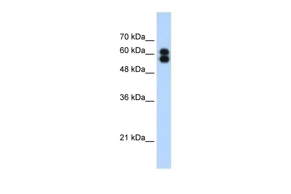 ALPP Antibody