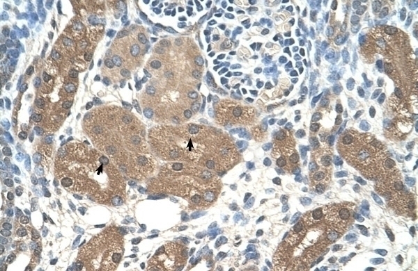 ACP1 Antibody