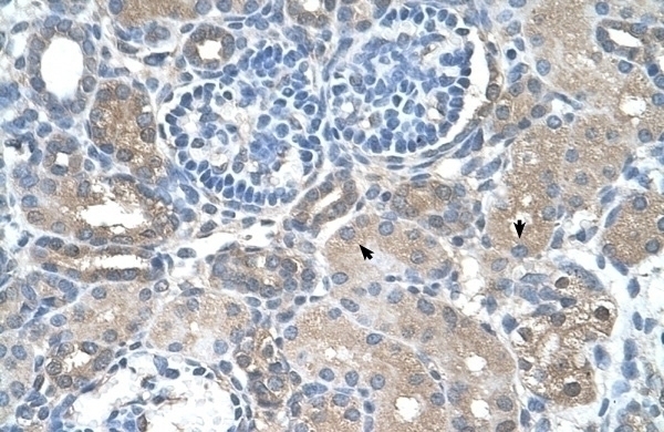 SARDH Antibody